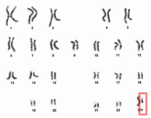 Y chromosome
